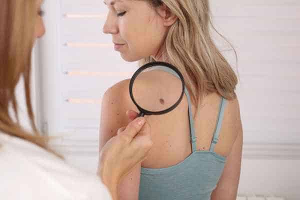 What Are Traditional Skin Lesion Removal Methods Keighley?