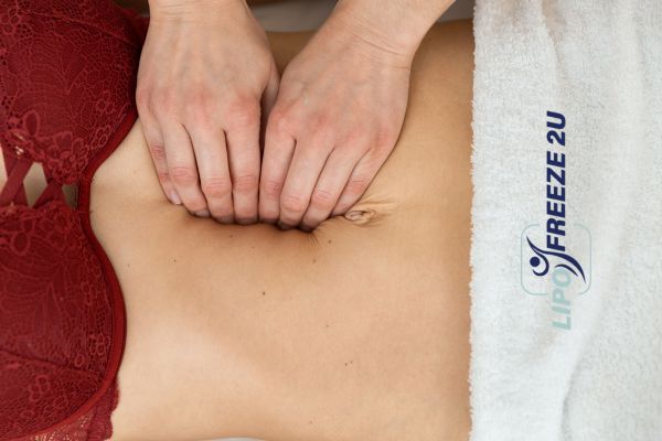 diastasis recti treatment Keighley