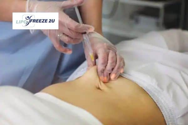 How Does Aqualyx Fat Dissolving Injection Work to Break Down Fat Keighley?