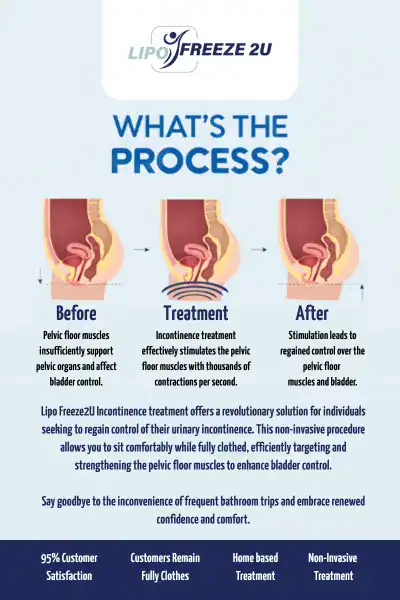 Diagram of how incontinence treatment Keighley works.
