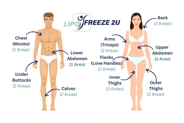 Areas you can have fat freezing treatment Keighley