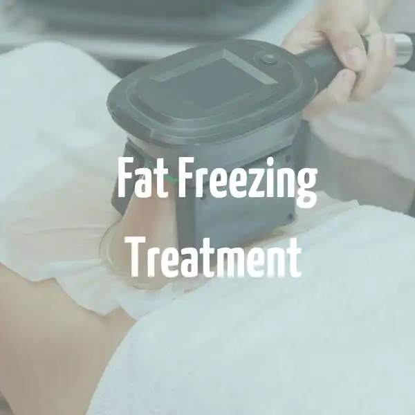 fat freezing treatment Keighley