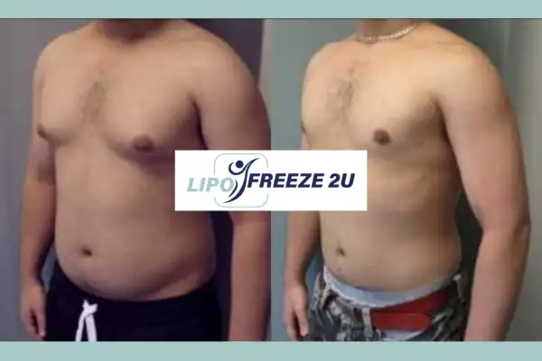 How Long Does It Take to See Results Keighley?