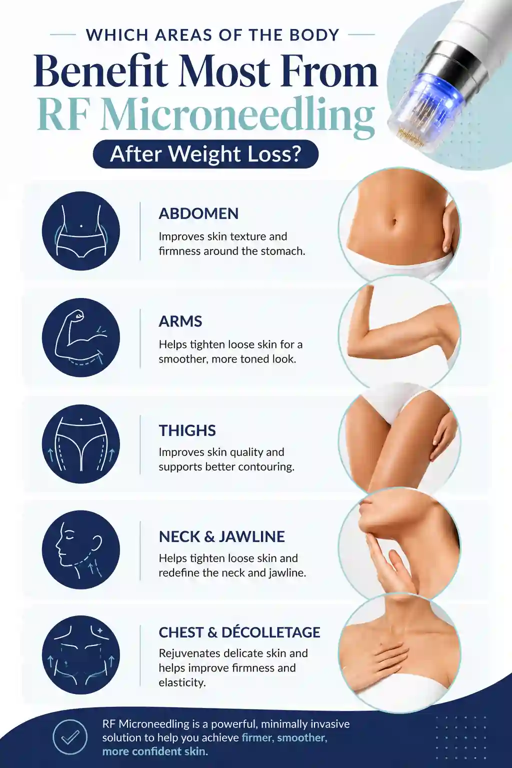 Which Areas of the Body Benefit Most From RF Microneedling After Weight Loss Keighley